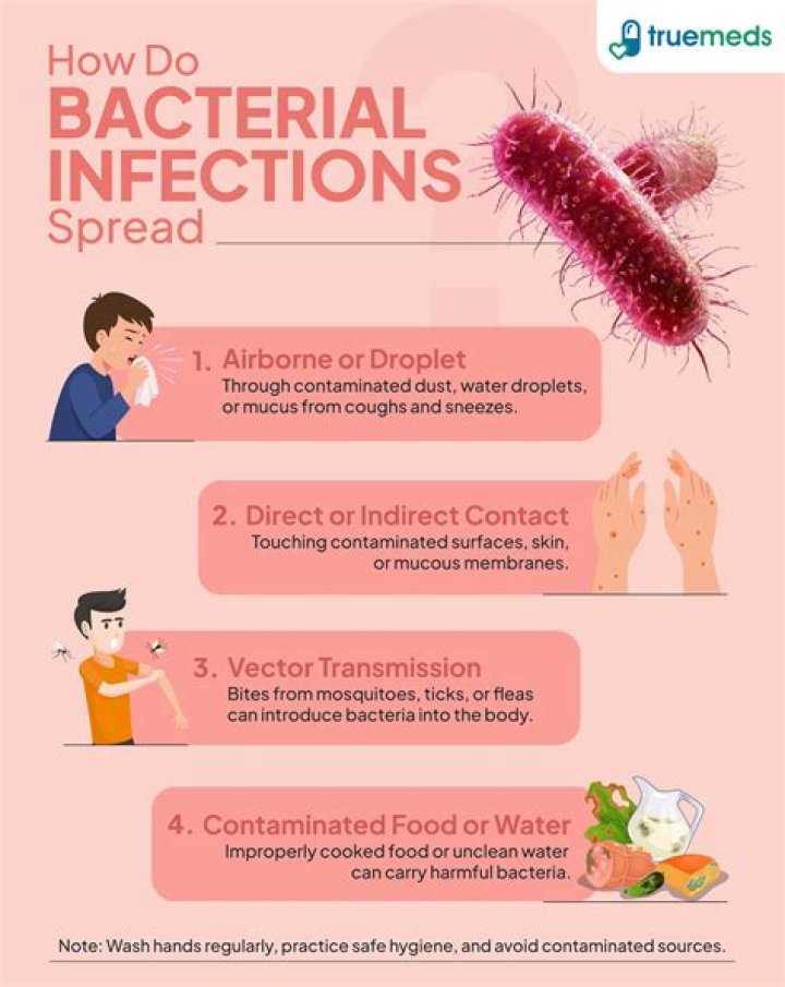 Deadly Bacterial Infection From Rats Is on the Rise—These Are the Flu-Like Symptoms